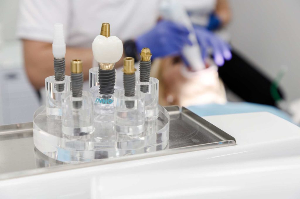 Implanturi dentare: 9 mituri despre procedura de implantare