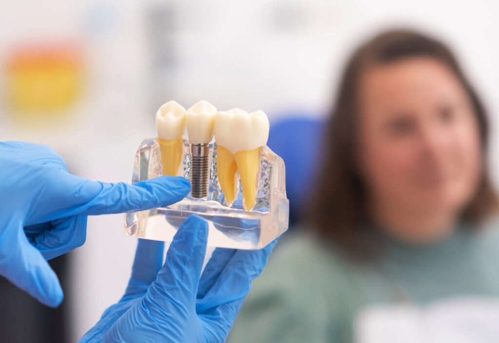 Protezare dentară: de ce nu poate fi amânată?