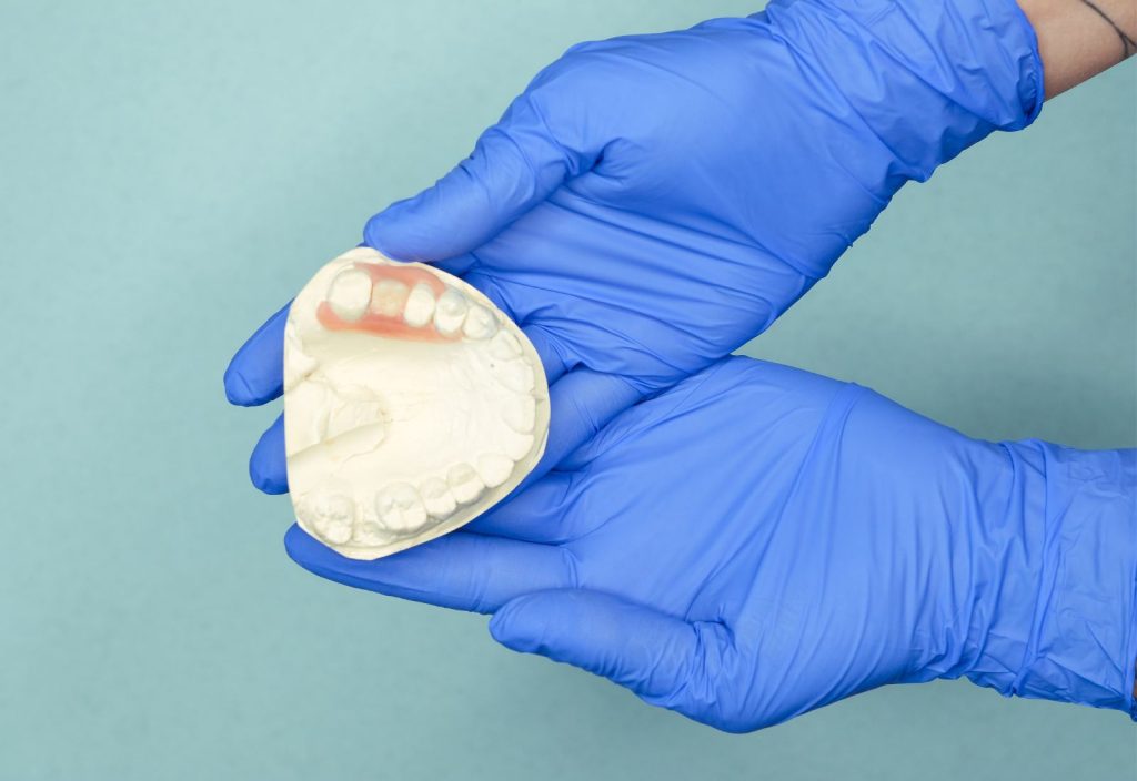 Proteza pe implanturi și sănătatea osului pentru menținerea structurii faciale