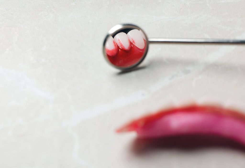 depistare boală gingivală pentru tratament parodontoză