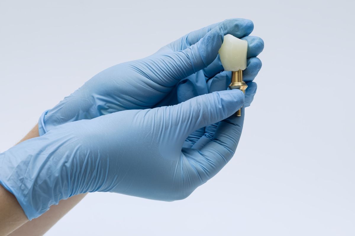 coroana pe implant macheta in maini
