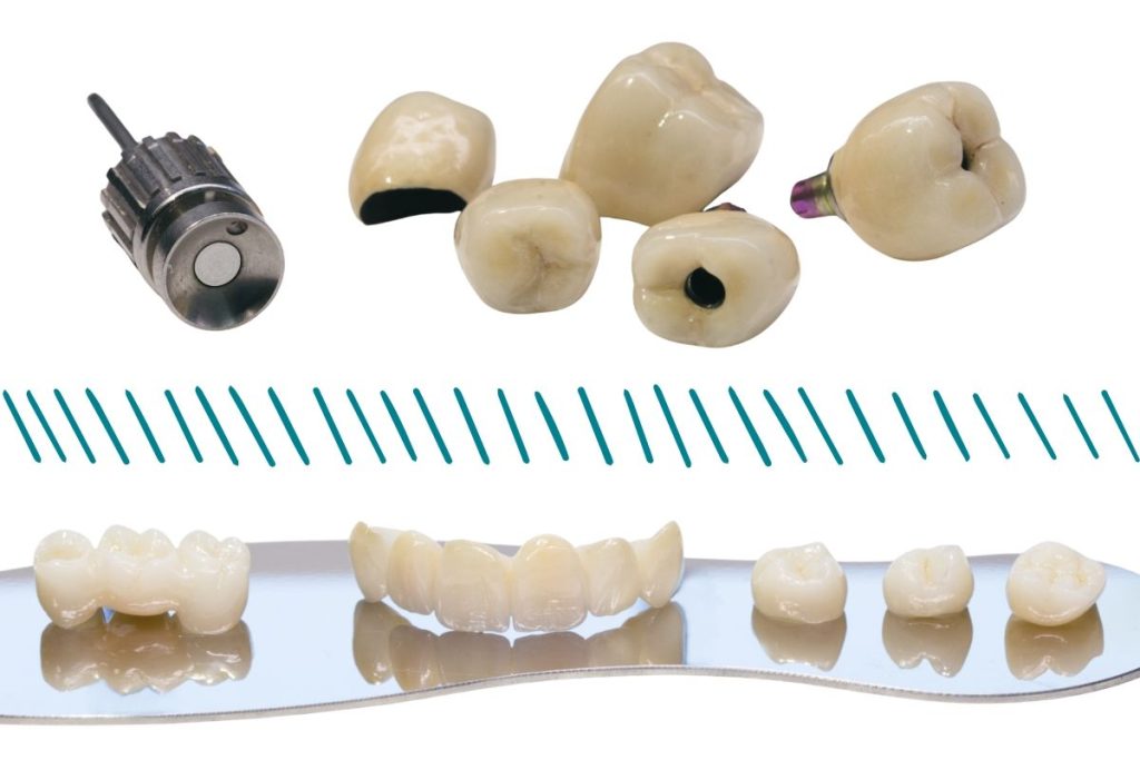 topiri de coroane montate pe implant